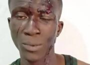 FCT Police Arrest Kogi Notorious Armed Robber for Stabbing Victim Over an iPhone
